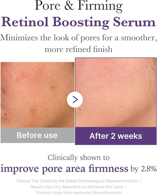 Medicube Retinol NMN Boosting Serum 30ml – Anti-Aging Serum for Sensitive Skin | Wrinkle Repair & Skin Tightening Pakistan