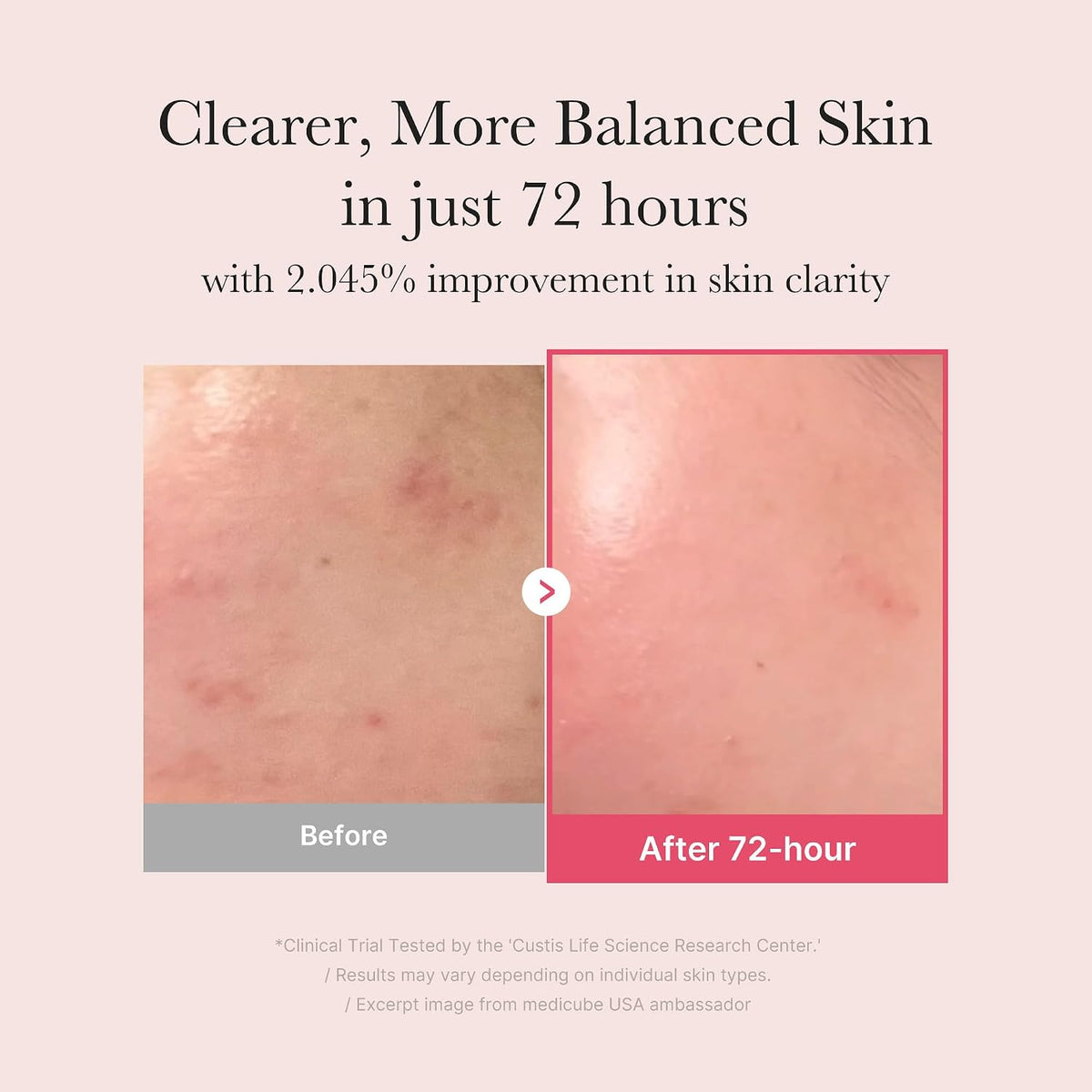 medicube TXA + Niacinamide 15% Glow Facial Serum 30ml