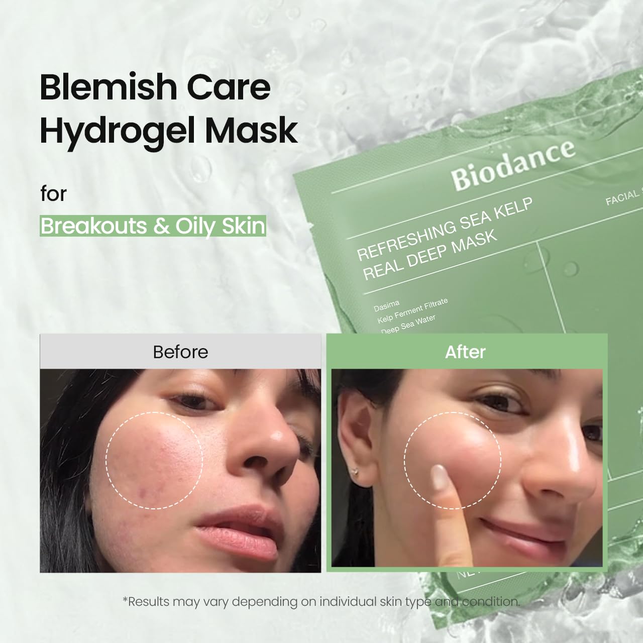 BIODANCE Refreshing Sea kelp Real Deep Mask, Overnight Hydrogel Face Mask, Calming, Oil & Sebum Control, Blemish Care, After Sun Care, Sunburn Relief, Korean Skin Care | 1.19oz(34g)