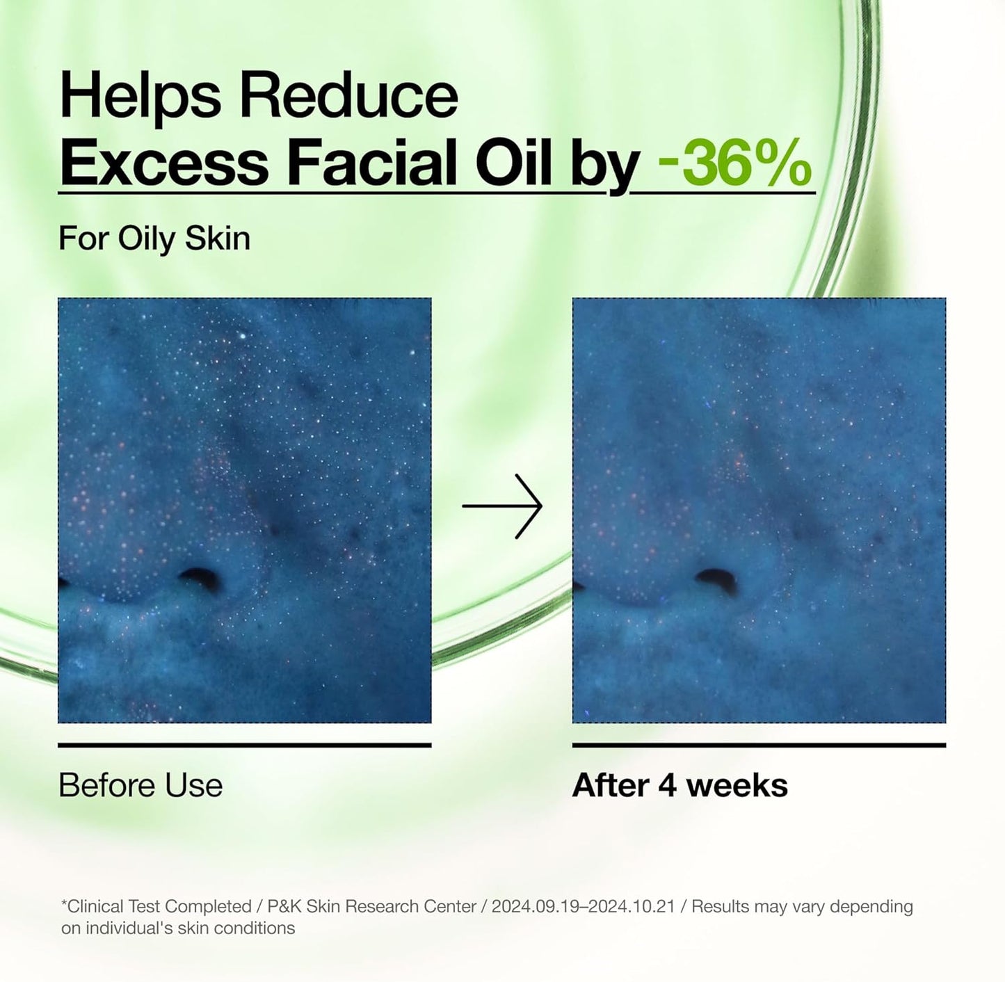 ANUA Azelaic Acid 10% Hyaluron Serum 30ml – Redness Soothing, Acne Treatment & Brightening Serum in Pakistan