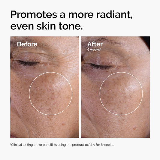 The Ordinary Glycolic Acid 7% Exfoliating Toner, Brightening and Smoothing Daily Toner for More Even-Looking Skin Tone, Amazon Product