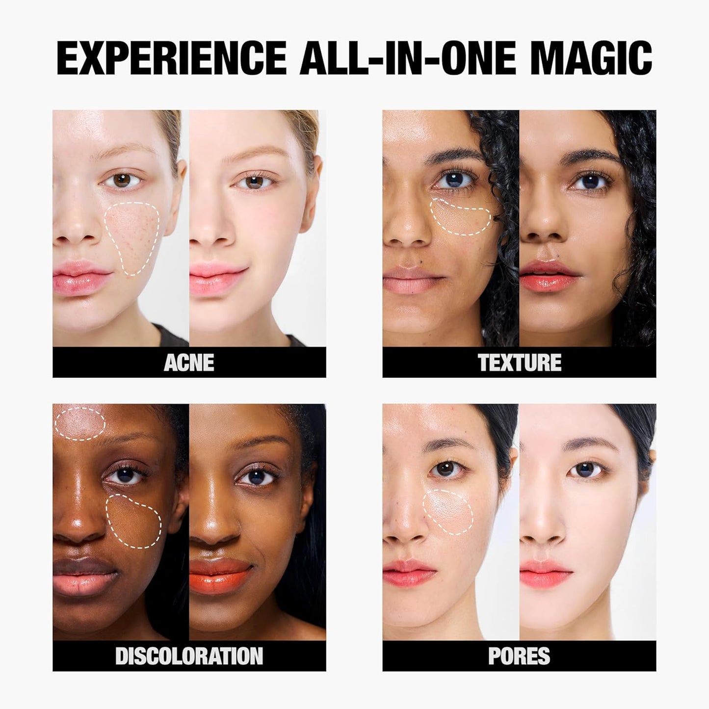 T-FIT 3 Color Concealer Palette, Popular, T Fit Concealer, Dark Bears, Spots, Nasolabial, Corners and Acne Marks, Cream Texture 3 Color Adjustable, Suitable for Natural Skin